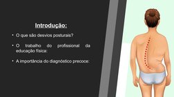 Introdução:
• O que são desvios posturais? 
• O 
trabalho 
do 
profissional 
da 
educação física:
• A importância do diagnóst