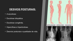 HIPERLORDOSE    HIPERCIFOSE     ESCOLIOSE
DESVIOS POSTURAIS:
• A escoliose: 
• Escoliose idiopática.
• Escoliose congênita.