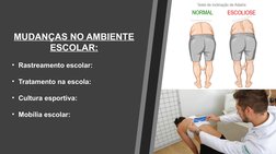 MUDANÇAS NO AMBIENTE 
ESCOLAR:
• Rastreamento escolar:
• Tratamento na escola:
• Cultura esportiva:
• Mobília escolar:
