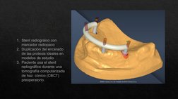 PLANIFICACIÓN 
CONVENCIONAL 
实验室软件 - (https://www.medicalexpo.com.cn/prod/egs/product-72570-678032.html) DentalCad  (https://