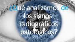 ¿Qué analizamos de
los signos´
radiográficos 
patológicos?
