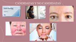 CANDIDATAS Y NO CANDIDATAS
