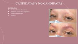 CANDIDATAS Y NO CANDIDATAS
CANDIDATAS
●
En el uso de lentes de contacto
●
Problemas de vista para maquillarse
●
Alérgicas al
