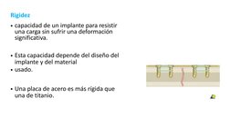 Rigidez 
• capacidad de un implante para resistir  
una carga sin sufrir una deformación  
significativa. 
• Esta capacidad d