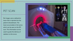 PET SCAN 
Pet images uses a radioactive 
tracer that is injected into the 
patient’s bloodstream. The 
tracer accumulates in