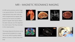 MRI – MAGNETIC RESONANCE IMAGING
An MRI machine produces section image 
in any special directions. The normal MRI 
image basi