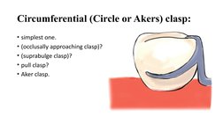 Types of Clasps in RPD Design | PDF | Mouth | Dentistry Branches