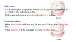 Types of Clasps in RPD Design | PDF | Mouth | Dentistry Branches