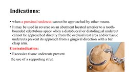 Types of Clasps in RPD Design | PDF | Mouth | Dentistry Branches