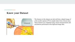 Know your Dataset
The features in this dataset are derived from a digital image of 
a fine needle aspirate (FNA) sample taken