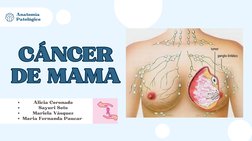 CÁNCER
DE MAMA
CÁNCER
DE MAMA
Alicia Coronado
Sayuri Soto
Mariela Vásquez
Maria Fernanda Paucar 
Anatomía
Patológico
