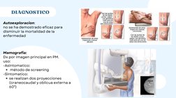 Autoexploracion: 
no se ha demostrado eficaz para
disminuir la mortalidad de la
enfermedad
 DIAGNOSTICO
 método de screening
