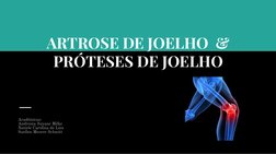 ARTROSE DE JOELHO  & 
PRÓTESES DE JOELHO
Acadêmicas:
Andrezza Suyane Milke
Natiele Carolina de Lins
Suellen Meurer Schmitt
