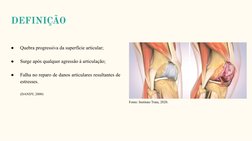 DEFINIÇÃO
●
Quebra progressiva da superfície articular;
●
Surge após qualquer agressão à articulação;
●
Falha no reparo de da