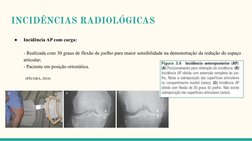 INCIDÊNCIAS RADIOLÓGICAS
●
Incidência AP com carga:
- Realizada com 30 graus de flexão de joelho para maior sensibilidade na
