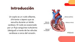 Introducción
Un soplo es un ruido silbante,
chirriante o áspero que se
escucha durante un latido
cardíaco. El ruido es ocasio