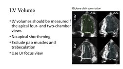 LV Volume
• LV volumes should be measured from 
the apical four- and two-chamber 
views
• No apical shorthening
• Exclude pap
