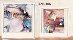 GANCHOS
