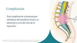 Complicación
Esta complicación se presenta por 
sobredosis del anestésico local y su 
absorción a nivel del sitio de la 
inye
