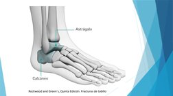 Rockwood and Green´s, Quinta Edición. Fracturas de tobillo
