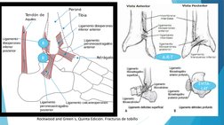 R
A-R-T
R
EVITA-
LAT
Rockwood and Green´s, Quinta Edición. Fracturas de tobillo
