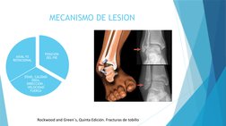 MECANISMO DE LESION
POSICION 
DEL PIE
EDAD, CALIDAD 
OSEA, 
DIRECCION , 
VELOCIDAD 
FUERZA
AXIAL VS 
ROTACIONAL
Rockwood and