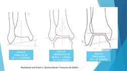 ANGULO 
BIMALEOLAR
82 +// 4 GRADOS
ANGULO 
TIBIOCRURAL
75 A  87 GRADOS
ANGULO 
TIBIOMALEOLAR 
MEDIAL Y LATERAL
53 Y 52 GRADOS