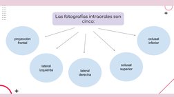 Las fotografías intraorales son 
cinco:
proyección 
frontal
lateral 
izquierda
lateral 
derecha
oclusal 
inferior
oclusal 
su