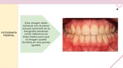 FOTOGRAFÍA 
FRONTAL 
Esta imagen debe 
tomarse con el plano 
oclusal centrado en la 
fotografía teniendo 
como referencia la