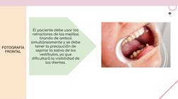 FOTOGRAFÍA 
FRONTAL 
El paciente debe usar los 
retractores de las mejillas 
tirando de ambos 
simultáneamente y se debe 
ten