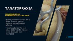 TANATOPRAXIA
PROCEDIMENTO EM 
NECROPSIADOS – O QUE É FEITO?
Aspiração das cavidades nasal 
e oral e introdução de 
algodão n