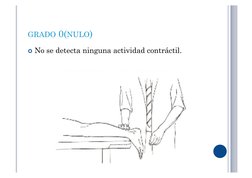 GRADO 0(NULO) 
 No se detecta ninguna actividad contráctil. 
