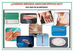 ¿CUÁNTOS MÉTODOS ANTICONCEPTIVOS HAY? 
HAY MAS DE 20 METODOS: 
