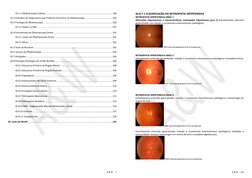 A & W
7
42.1.1 Oftalmoscopia Indireta .......................................................................................