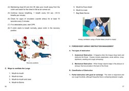 C. Ways to ventilate the Lungs
1. Mouth-to-mouth
2. Mouth-to-nose
3. Mouth-to-mouth and nose
4. Mouth-to-Stoma
(4) Maintainin