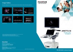 Image Gallery
High quality imaging across a broad clinical range that includes abdominal, cardiac, and vascular applications.