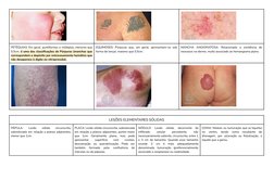 PETÉQUIAS: Em geral, puntiformes e múltiplas, menores que
0,5cm, é uma das classificações de Púrpuras (manchas que
correspond