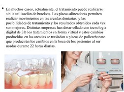• En muchos casos, actualmente, el tratamiento puede realizarse 
sin la utilización de brackets. Las placas alineadoras perm