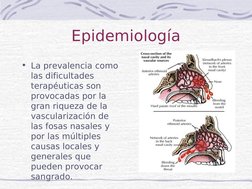 Epidemiología
• La prevalencia como 
las dificultades 
terapéuticas son 
provocadas por la 
gran riqueza de la 
vasculari