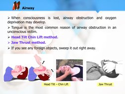  When consciousness is lost, airway obstruction and oxygen 
deprivation may develop. 
 Tongue is the most common reason of