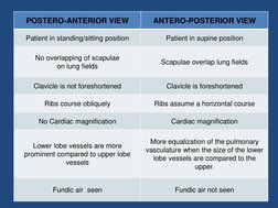 Lordotic and Apicogram Chest X-Ray Guide | PDF | Lung | Thorax