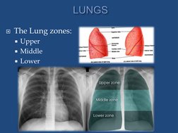 Lordotic and Apicogram Chest X-Ray Guide | PDF | Lung | Thorax
