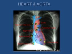Lordotic and Apicogram Chest X-Ray Guide | PDF | Lung | Thorax