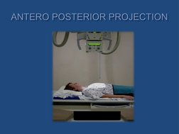 Lordotic and Apicogram Chest X-Ray Guide | PDF | Lung | Thorax