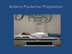 Lordotic and Apicogram Chest X-Ray Guide | PDF | Lung | Thorax