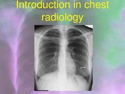 Chest Radiology Techniques Overview | PDF | Thorax | Lung