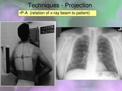 Chest Radiology Techniques Overview | PDF | Thorax | Lung
