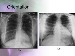 Chest Radiology Techniques Overview | PDF | Thorax | Lung