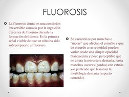 FLUOROSIS 
 
La fluorosis dental es una condición 
irreversible causada por la ingestión 
excesiva de fluoruro durante la 
f