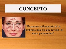 CONCEPTO
CONCEPTO
“Respuesta inflamatoria de la 
membrana mucosa que reviste los 
senos paranasales”.
“Respuesta inflamatoria